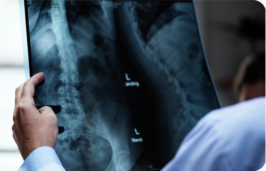 Radiografia sendo analisada por médico